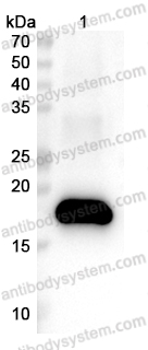 Anti-HPV16 E7/Protein E7 Polyclonal Antibody